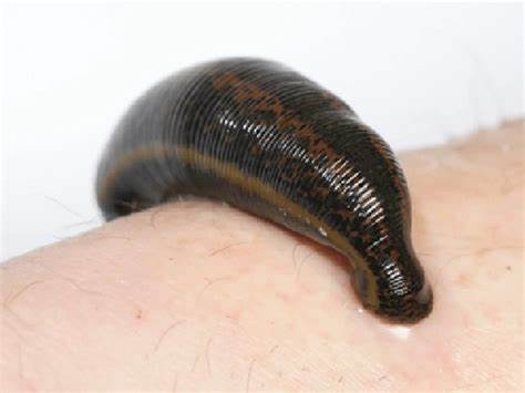 đỉa cắn người